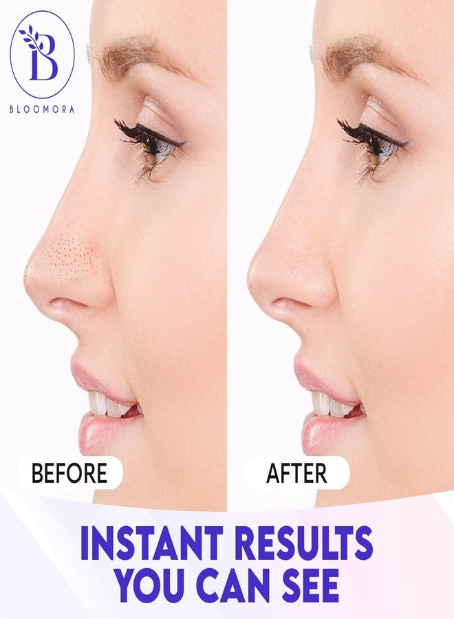 BLOOMORA Nose Pore Strips, Nose Strips Blackhead Remover with Witch Hazel for Deep Cleansing, Pore Cleaner & Whitehead Remover, Skincare For Clearer, Smoother, Radiant Skin (24 pc) - Image 3